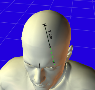 Y distance marked along the midline on top of the head